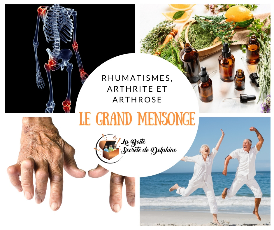 Illustration de l'article : Quel est le plus grand mensonge sur les rhumatismes, l'arthrite et l'arthrose