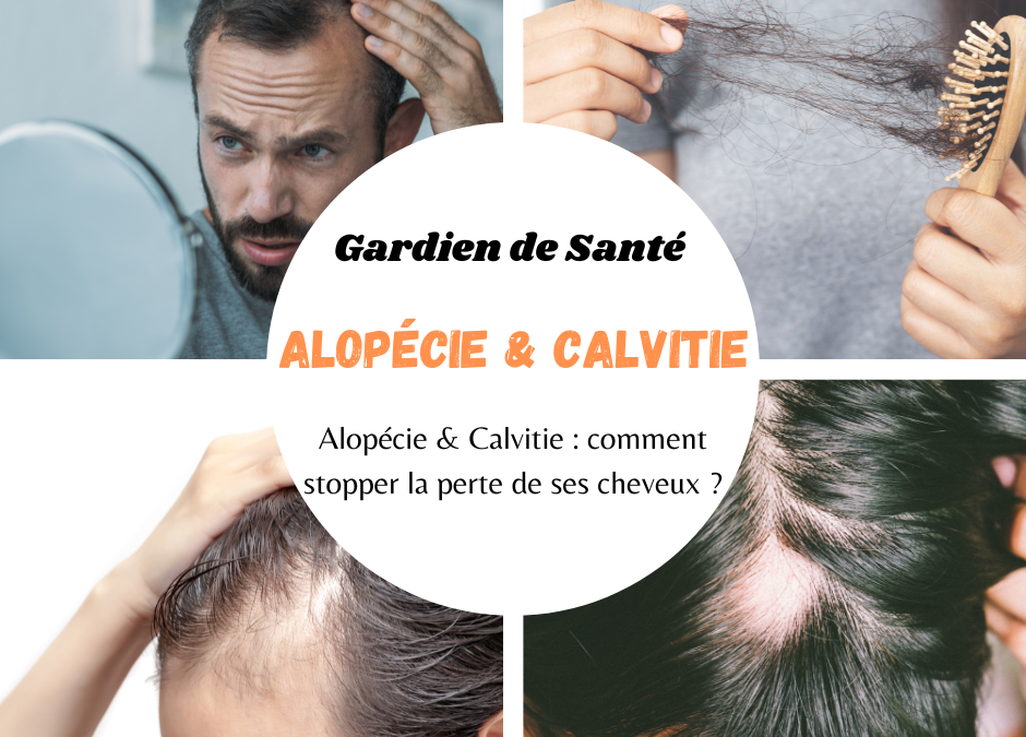 Alopécie & Calvitie : comment stopper la perte de ses cheveux ?